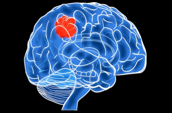 Симптомы и лечение кисты головного мозга