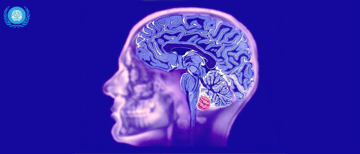 Что показывает МРТ сосудов головного мозга, как делают МРТ